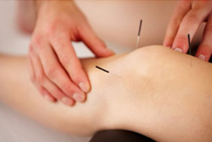 Dry Needling Therapy For Chronic Musculoskeletal Pain: